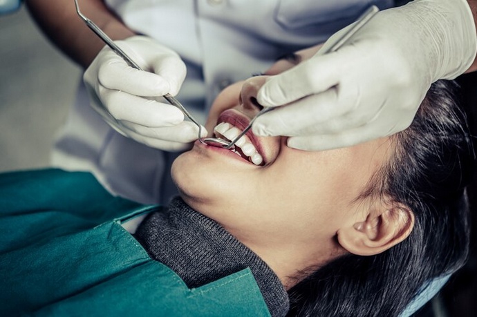 Filling in the Gaps: All About Teeth Fillings