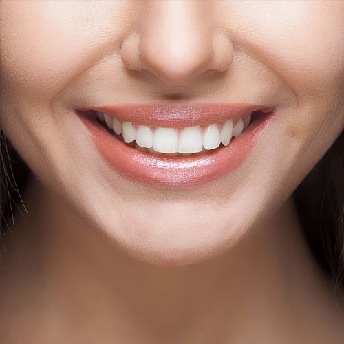 Reveal Your Best Smile Yet: The Magic of Dental Veneers