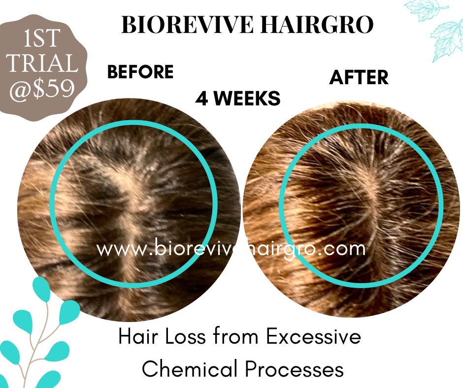 Top 10 Reasons to Choose BioRevive HairGro