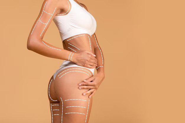 Sculpt Your Ideal Shape: Exploring Body Contouring Treatment Options