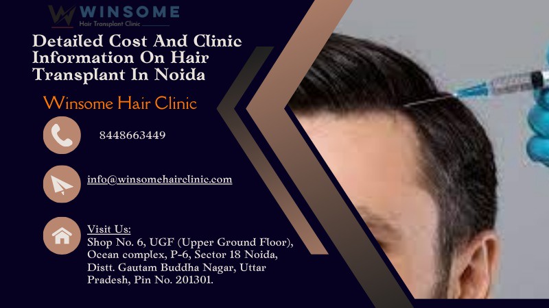 Detailed Cost And Clinic Information On Hair Transplant In Noida — Winsome Hair Clinic