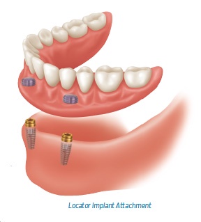 A Fresh Approach to Your Dental Care: What to Expect During Your Office Visit