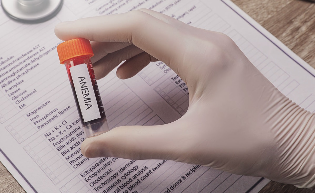 Understanding Anemia: Exploring ICD-10 Codes and Diagnosis