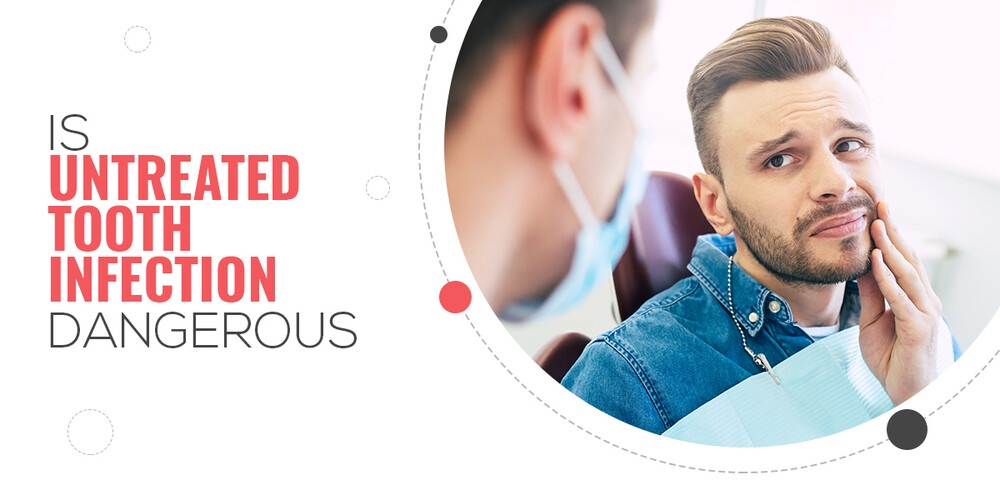 Is Untreated Tooth Infection Dangerous?