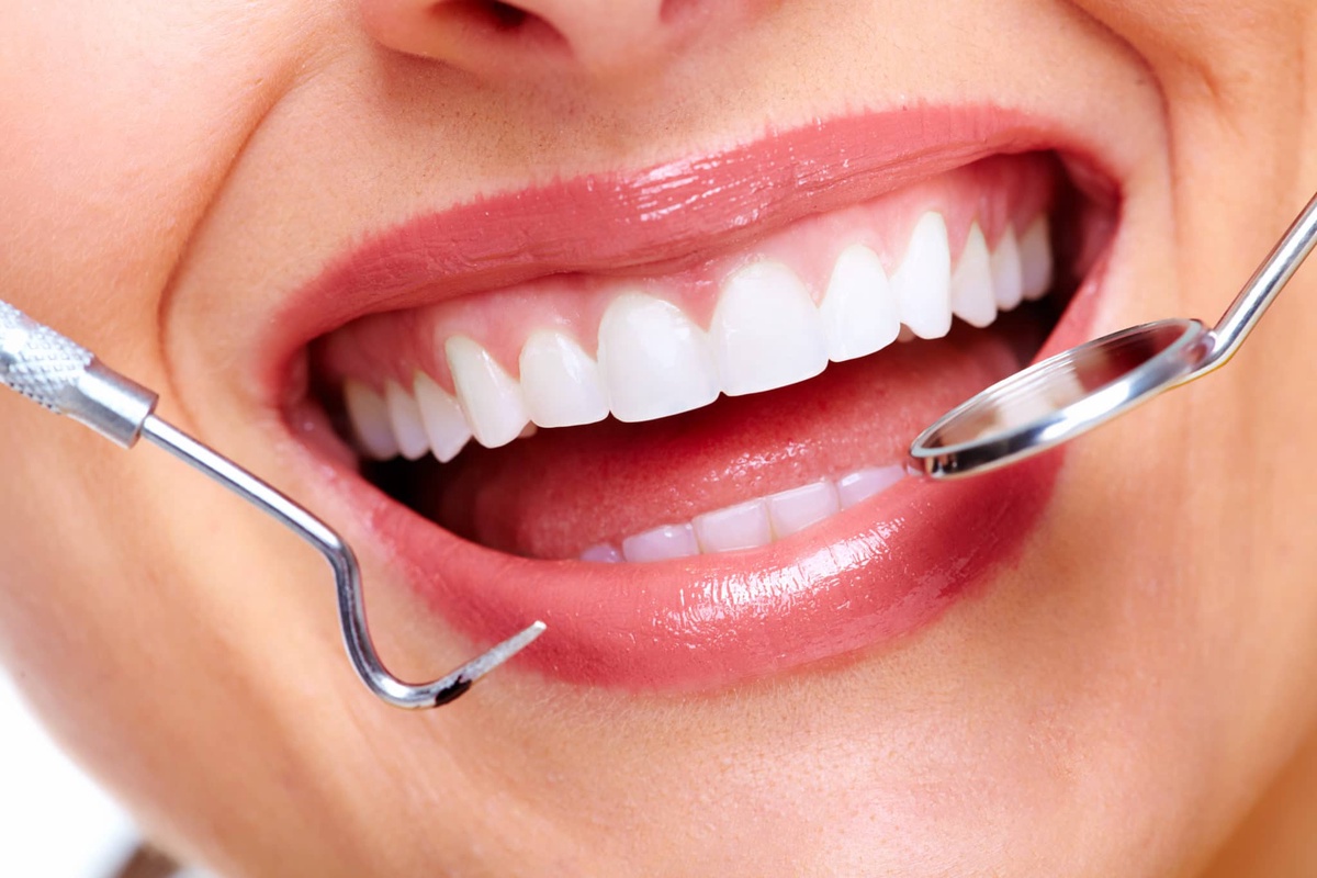 Mouthguards 101: Everything You Need to Know to Keep Your Teeth Intact