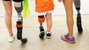 artificial limbs
