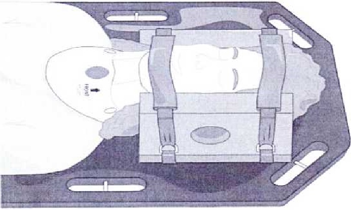 Management of Injuries to the Skull, Spinal Column, and Chest