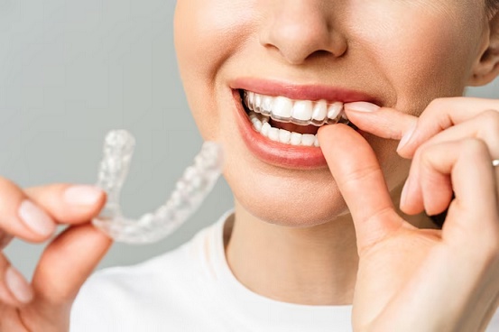 Comparing Invisalign Providers: Key Factors to Evaluate