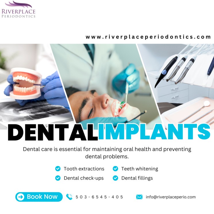 Are Dental Implants Safe or Not ?