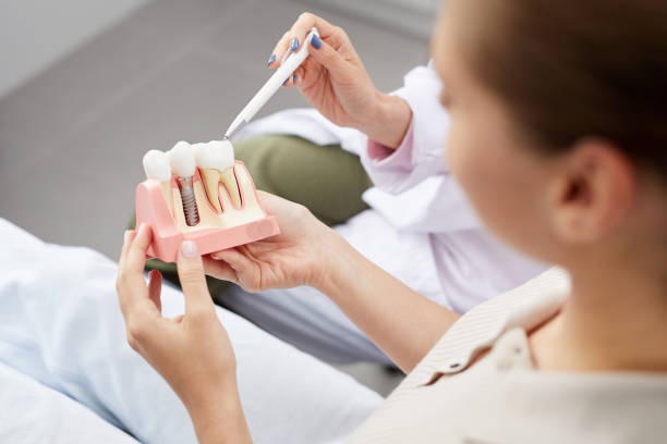 What is Dental Implants Therapy ?