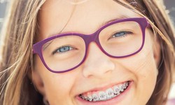 5 Tips To Maintain Your Invisaligners Better