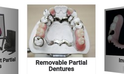 How To Find Well-Fitting Full Dentures