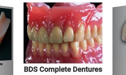 What You Should Know Before Opting For Dentures