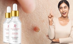 Amarose Skin Tag Remover: Fact Checked, Amarose Skin Tag Remover Legit!!