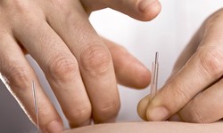 The Cost-Effectiveness of Acupuncture for Back Pain Treatment Introduction