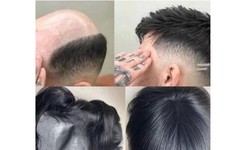 What can you do with Mens hair systems