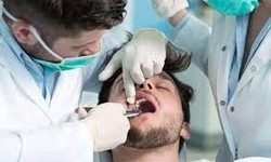 Most Common Types Of Dental Treatments
