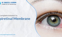 A Complete Solution To Epiretinal Membrane