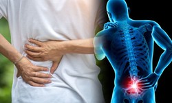 Ease Your Pain: The Best Medicines For Back Pain Relief