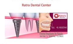 Best Dental Implant Clinic in Noida: A Complete Guide
