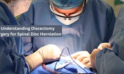 Understanding Discectomy Surgery for Spinal Disc Herniation