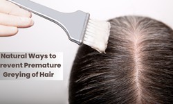 Natural Ways to Prevent Premature Greying of Hair
