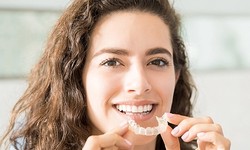 Some Interesting Facts About Invisalign Treatment