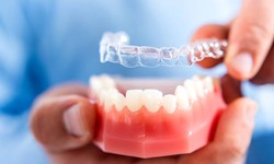 Top 5 Reasons Why Invisalign is Ideal for Your Child