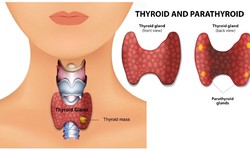 Thyroid Problems & Disease – Types and Causes