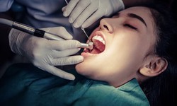 What Are Orthodontics And Its Benefits For Dental Irregularities