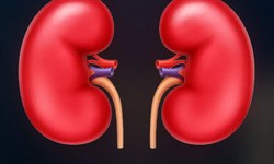 When One Need Kidney Transplant
