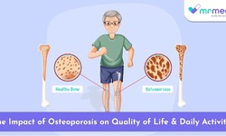 The Impact of Osteoporosis on Quality of Life and Daily Activities