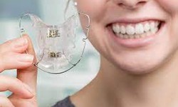 Maintaining Oral Hygiene with Invisalign: Tips and Tricks