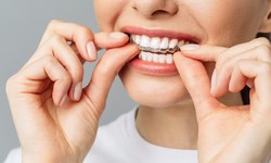 Orthodontists And Their Ways To Treat Patients With Invisalign