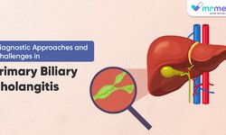 Diagnostic Approaches and Challenges in Primary Biliary Cholangitis