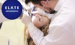 Transform Your Smile with Trusted Orthodontist