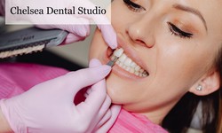 Elevate Your Smile with Trusted Dental Studio