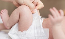 How to Prevent Diaper Rash in Newborns: Tips and Tricks