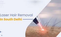 Say Goodbye To Uncontrollable Hair Growth With Laser Hair Removal In South Delhi