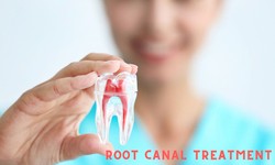 7 Major Symptoms When You need to Perform a Root Canal