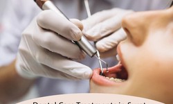 The Root Canal Treatment: An Overview