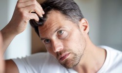 Hair Loss? Dubai Has the Solution You've Been Searching For
