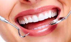 A Brighter Smile Awaits: Exploring the Benefits of Professional Teeth Whitening