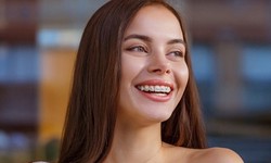 "Your Journey to a Beautiful Smile: A Comprehensive Guide to Dental Braces"