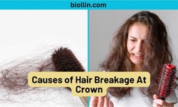 Causes of Hair Breakage At Crown