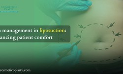 Pain management in liposuction: Enhancing patient comfort