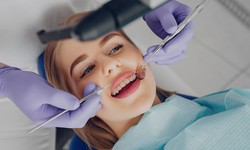 How Cosmetic Dentistry Can Make Brides Smile Brighter?