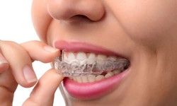 Can You Drink Coffee While Wearing Invisalign?