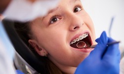 Stuck Food in Teeth Can Lead to Plaque