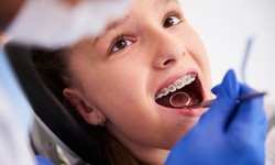 Stuck Food in Teeth Can Lead to Plaque